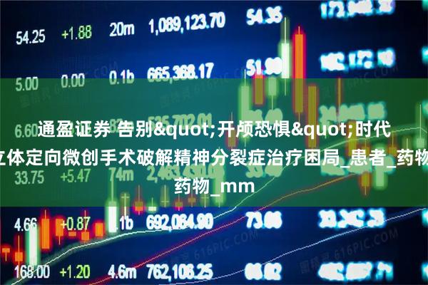 通盈证券 告别"开颅恐惧"时代，脑立体定向微创手术破解精神分裂症治疗困局_患者_药物_mm